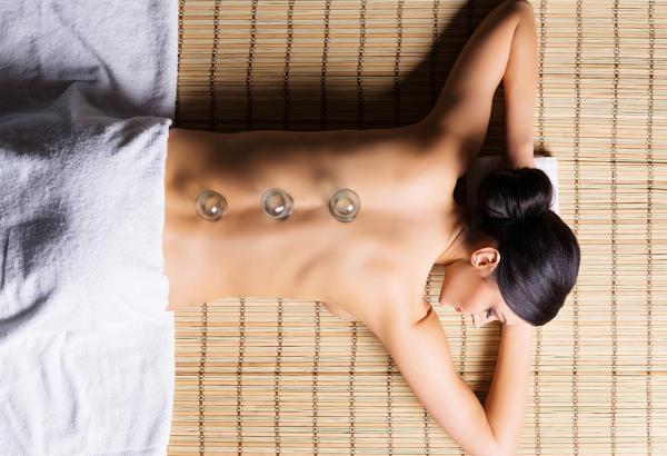 cupping acupuncture school